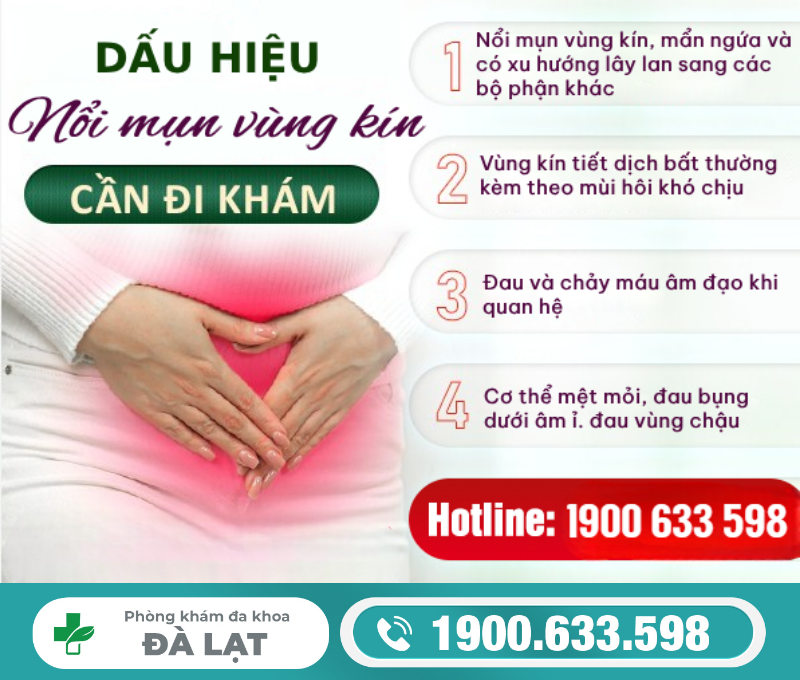 Hình ảnh minh họa